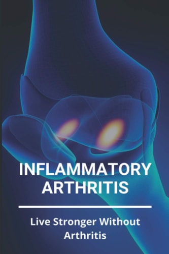Inflammatory Arthritis Live Stronger Without Arthritis: Rheumatoid Arthritis Ppt
