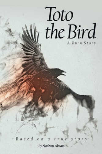 Toto the Bird A Burn Story