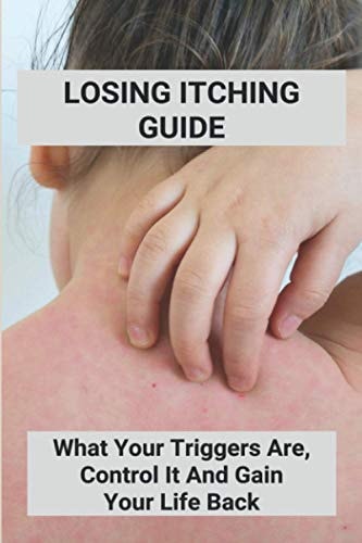 Losing Itching Guide What Your Triggers Are, Control It And Gain Your Life Back: Stretch Marks Itch When Losing Weight