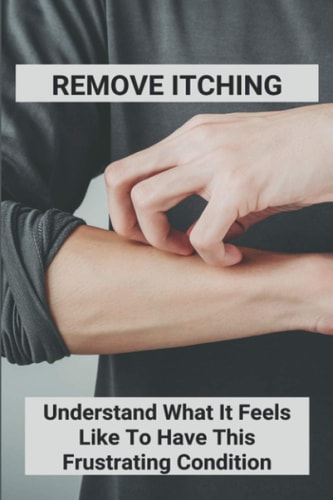 Remove Itching Understand What It Feels Like To Have This Frustrating Condition: Stretch Marks Itch While Losing Weight
