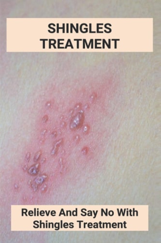 Shingles Treatment Relieve And Say No With Shingles Treatment: Shingles On Face Treatment