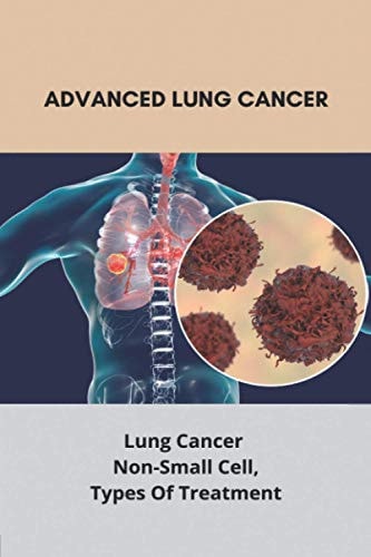 Advanced Lung Cancer Lung Cancer - Non-Small Cell, Types Of Treatment: Lung Cancer Survival Rate