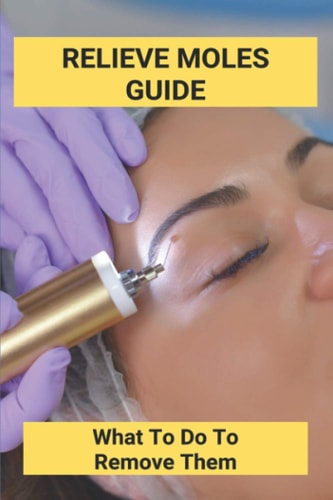 Relieve Moles Guide What To Do To Remove Them: Getting Rid Of Moles In The Yard