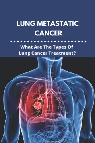 Lung Metastatic Cancer What Are The Types Of Lung Cancer Treatment?: Stage 3 Lung Cancer