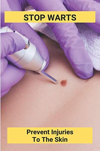 Stop Warts Prevent Injuries To The Skin: Warts Treatment Near Me