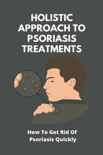 Holistic Approach To Psoriasis Treatments How To Get Rid Of Psoriasis Quickly: Is Psoriasis Itchy