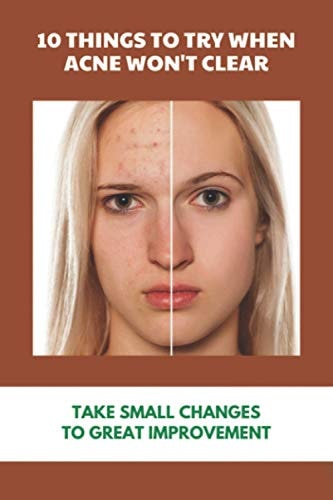 10 Things To Try When Acne Won't Clear Take Small Changes To Great Improvement: Holistic Ways To Eliminate Acne