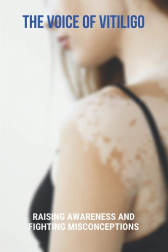 The Voice Of Vitiligo Raising Awareness And Fighting Misconceptions: Tips On Finding Your Purpose In Life