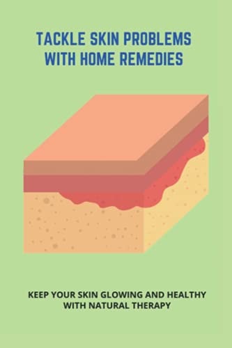 Tackle Skin Problems With Home Remedies Keep Your Skin Glowing And Healthy With Natural Therapy: How To Get Rid Of Acne In Adults