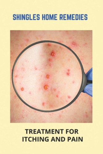 Shingles Home Remedies Treatment For Itching And Pain: Shingles Recovery Stages