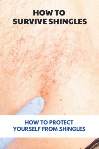 How To Survive Shingles How To Protect Yourself From Shingles: How To Speed Up Shingles Recovery