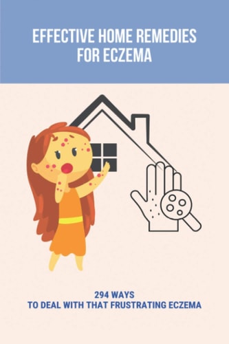 Effective Home Remedies For Eczema 294 Ways To Deal With That Frustrating Eczema: Homeopathic Remedies For Eczema