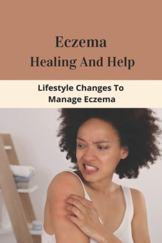 Eczema Healing And Help Lifestyle Changes To Manage Eczema: What Foods To Eat To Cure Eczema