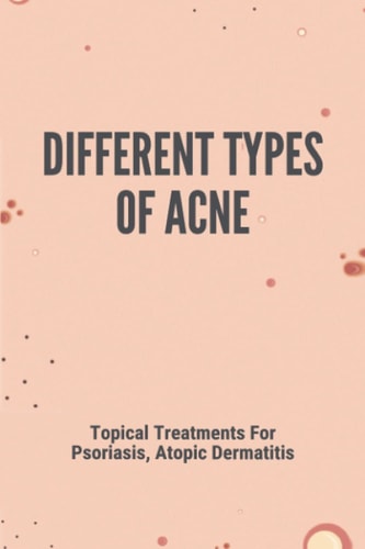 Different Types Of Acne Topical Treatments For Psoriasis, Atopic Dermatitis