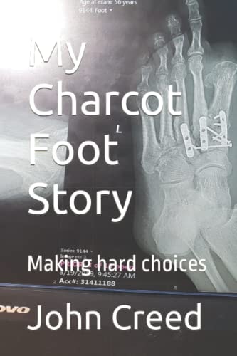My Charcot Foot Story Making Hard Choices