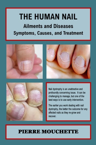 THE HUMAN NAIL - Ailments and Diseases Symptoms, Causes, and Treatment