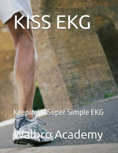 Kiss EKG Keeping It Super Simple EKG