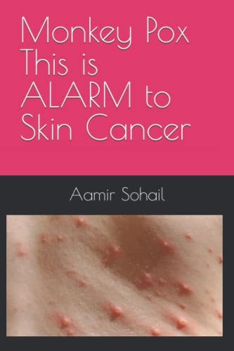Monkey Pox This is ALARM to Skin Cancer