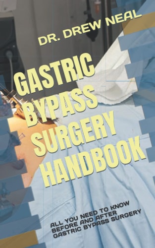 Gastric Bypass Surgery Handbook All You Need to Know Before and After Gastric Bypass Surgery