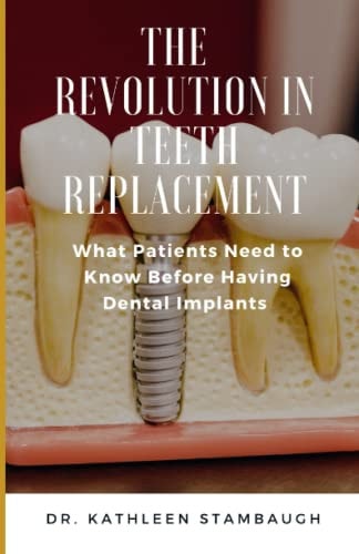 The Revolution in Teeth Replacement What Patients Need to Know Before Having Dental Implants