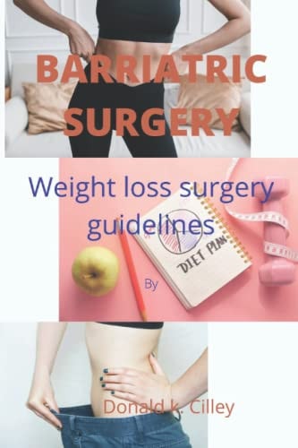 Barriatric Surgery Weight Loss Surgery Guidelines