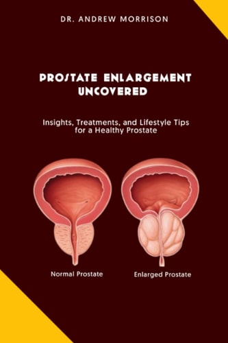 Prostrate Enlargement Uncovered Insights, Treatments, and Lifestyle Tips for a Healthy Prostate