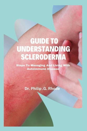 Guide to Understanding Scleroderma Steps to Managing and Living with Autoimmune Disease