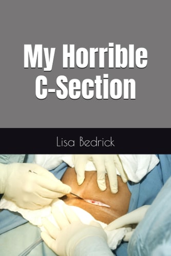 My Horrible C-Section