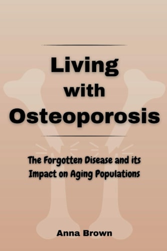 Living with Osteoporosis The Forgotten Disease and Its Impact on Aging Populations