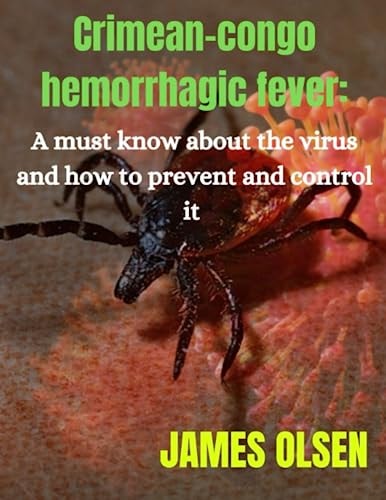 Crimean-congo Hemorrhagic Fever A Must Know about the Virus and how to Prevent it