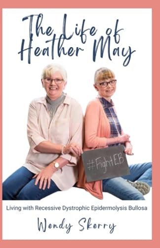 The Life of Heather May Living with Recessive Dystrophic Epidermolysis Bullosa
