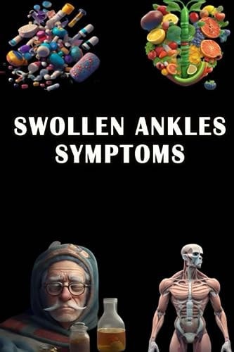 Swollen Ankles Symptoms Spot the Signs of Swollen Ankles - Prioritize Circulation and Foot Health!