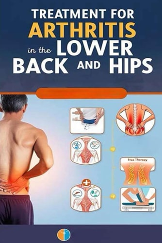 Treatment for Arthritis in the Lower Back and Hips Learn about Medications, Procedures, Therapies, and Home Remedies that Can Help You with Lumbar and Hip Arthritis.