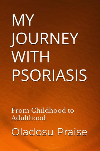 My Journey with Psoriasis From Childhood to Adulthood