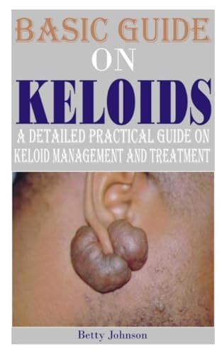 Basic Guide on Keloids A Detailed Practical Guide on Keloid Management and Treatment