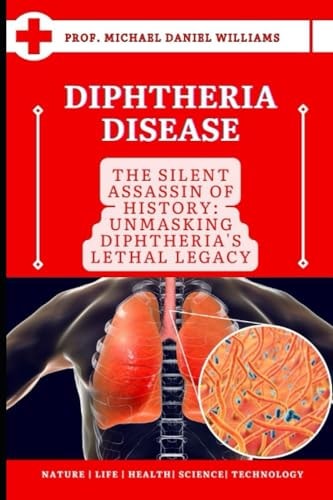Diphtheria Disease "The Silent Assassin of History: Unmasking Diphtheria's Lethal Legacy"