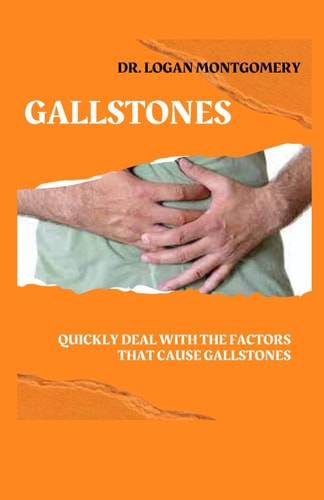 Gallstones Quickly Deal with the Factors That Cause Gallstones