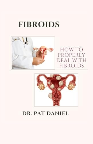 Fibroids How to Properly Deal with Fibroids