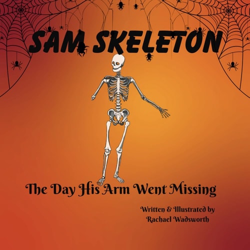 Sam Skeleton The Day His Arm Went Missing