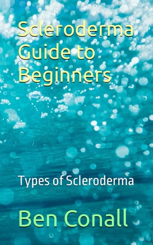 Scleroderma Guide to Beginners Types of Scleroderma