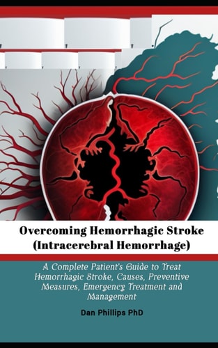 Overcoming Hemorrhagic Stroke(Intracerebral Hemorrhage) A Complete Patient's Guide to Treat Hemorrhagic Stroke, Causes, Preventive Measures, Emergency Treatment and Management