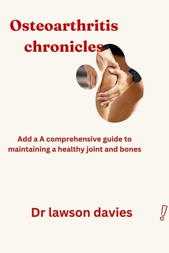 Osteoarthritis Chronicles A Comprehensive Guide to Maintain a Healthy Joint and Bones