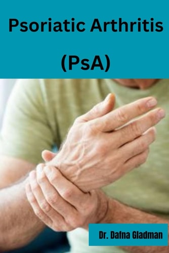 Psoriatic Arthritis (PsA) Empowered Living: Your Guide to Wellness and Hope with Psoriatic Arthritis