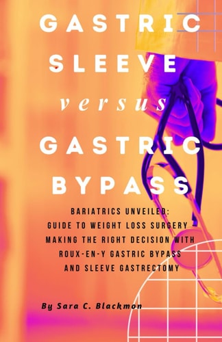 Gastric Sleeve Versus Gastric Bypass Bariatrics Unveiled: A Comprehensive Guide to Weight Loss Surgery - Making the Right Decision with Roux-en-Y Gastric Bypass and Sleeve Gastrectomy