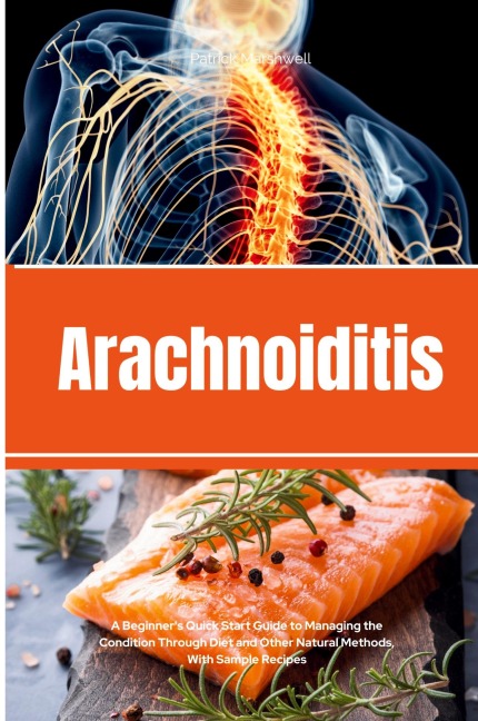 Arachnoiditis: A Beginners Quick Start Guide to Managing the Condition Through Diet and Other Natural Methods, With Sample Recipes