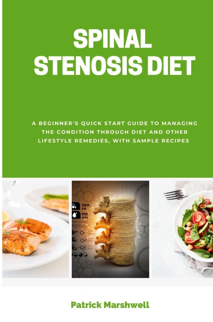 Spinal Stenosis Diet: A Beginners Quick Start Guide to Managing the Condition Through Diet and Other Lifestyle Remedies, With Sample Recipes
