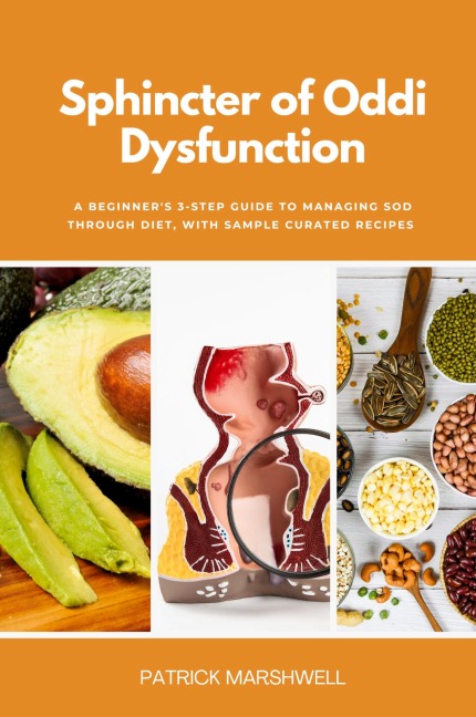 Sphincter of Oddi Dysfunction: A Beginners 3-Step Guide to Managing SOD Through Diet, With Sample Curated Recipes