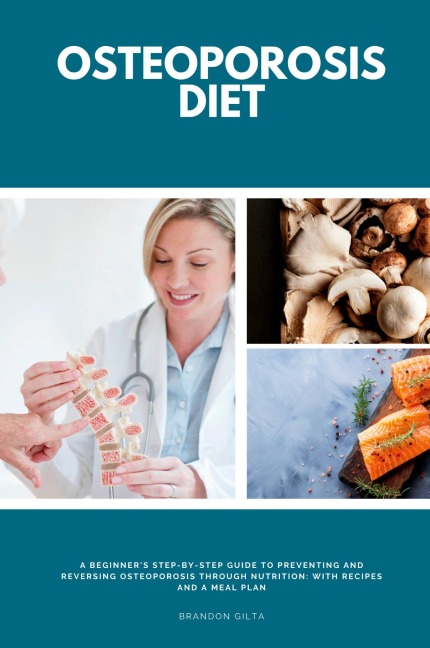 Osteoporosis Diet: A Beginners Step-by-Step Guide To Preventing and Reversing Osteoporosis Through Nutrition With Recipes and a Meal Plan