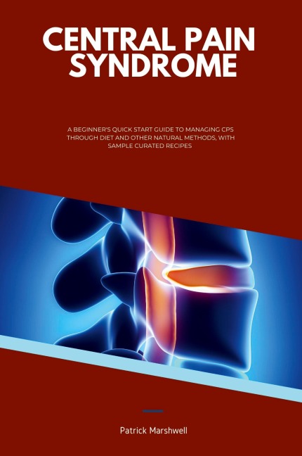 Central Pain Syndrome: A Beginners Quick Start Guide to Managing CPS Through Diet and Other Natural Methods, With Sample Curated Recipes