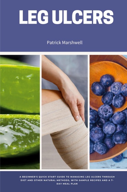 Leg Ulcers: A Beginners Quick Start Guide to Managing Leg Ulcers Through Diet and Other Natural Methods, With Sample Recipes and a 7-Day Meal Plan